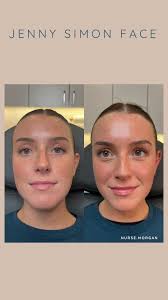 JennysimonFACE
