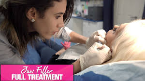 Fillers help to get rid of jowls by plumping the skin and thus redefining the jawline. Define That Jaw How To Get Rid Of Jowls With Dermal Filler Full Treatment Youtube