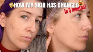 My Skincare Routine Jan Marini Skin Care Management System Review Youtube