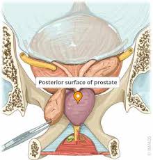 Image result for Prostate Anatomy