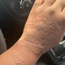 If it´s a matter of lightening the area with just a few sessions, or a complete removal, we are here to serve you.using. Houston Tattoo Removal Clinic 23 Photos Tattoo Removal 12841 Gulf Fwy Houston Tx Phone Number