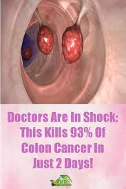 Pin On Home Remedies