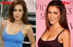 Pin On Plastic Surgery News