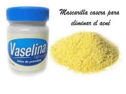 Trucos De Belleza Con Vaselina Y Azufre Para Pieles Con Acne Acne Caseros