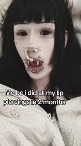 Cheek Flesh Tunnels Eating