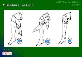 Pertolongan atau bantuan segera yang bersifat sementara diberikan kepada mangsa yang mengalami kemalangan atau kecederaan dengan segala kemudahan yang terdapat di tempat kejadian sebelum ketibaan bantuan perubatan atau sebelum mangsa mendapat. Pertolongan Cemas Anduh Pbsm Pengakap