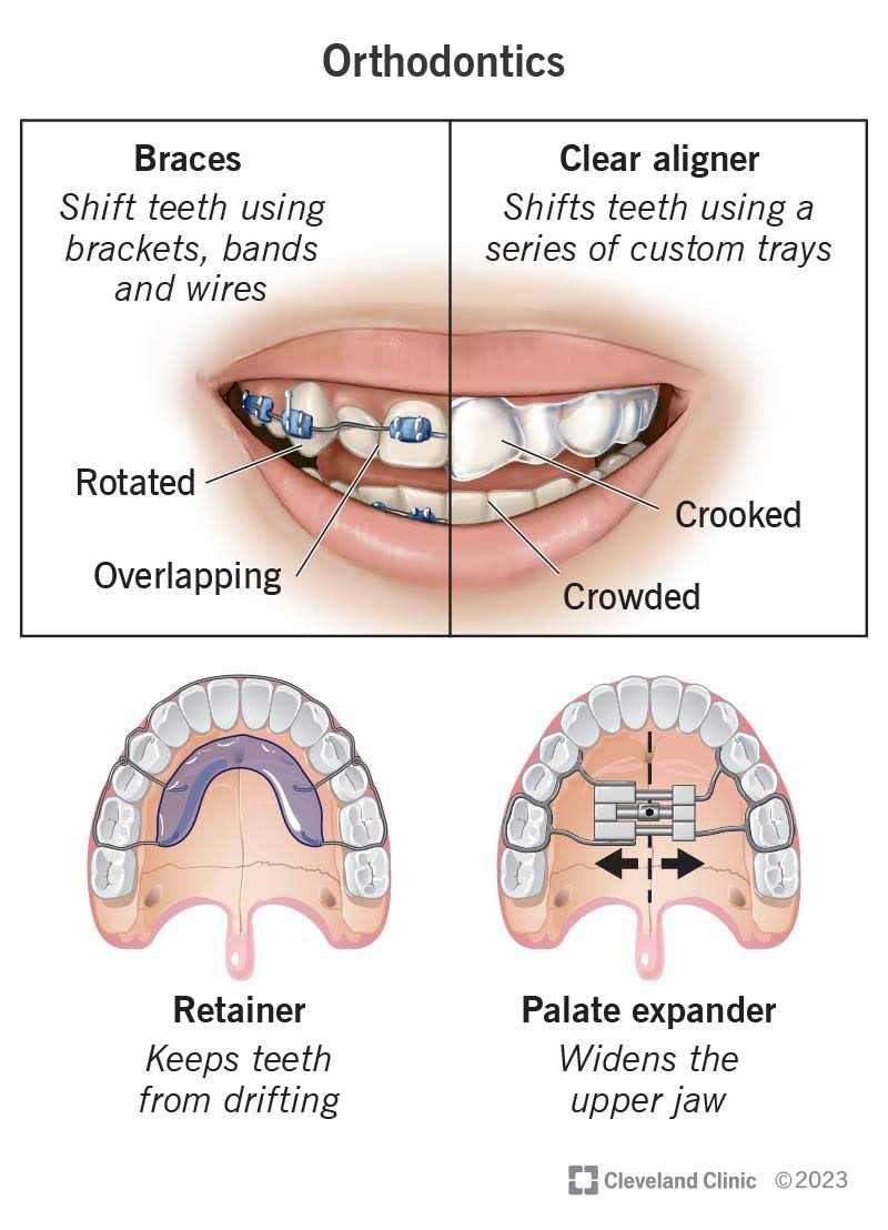 Orthodontics product image