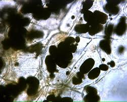 Plant cell under microscope 400x labeled. Potato 400x General Biology Lab Loyola University Chicago