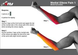 Pin On Kinesiology