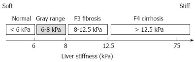 non invasive diagnosis of alcoholic liver disease