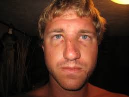 Aaron Eilers Is My Idol/Hero!!!