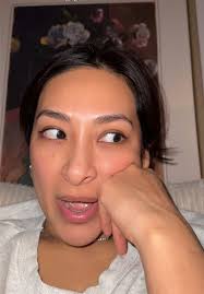 My iron infusion did not go as planned 🙂‍↔️😭😑 #lowiron #severeanemia  #anemic #iron #irondeficiency #irondeficiencyanemia