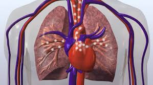 Learn vocabulary, terms, and more with flashcards, games, and other study tools. How The Main Pulmonary Artery Delivers Blood To The Lungs