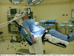 Figure 1 3 From The Effect Of Body Position On Cerebral Bllod Flow Cognition Cardiac Output Map And Motor Function In Patients Undergoing Shoulder Surgery Lateral Versus Beach Chair Position Under General Anesthesia