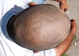 Couple getting married