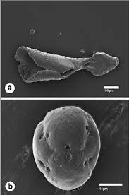 Image result for Raphionacme monteiroae