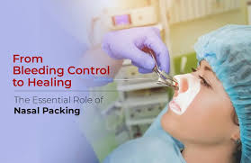 Image result for Nasal Packing