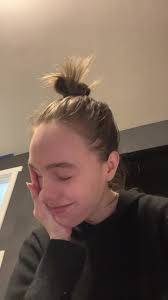 Ehlers Danlos Purple Feet