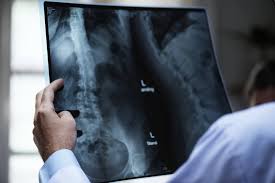 Aus wikipedia, der freien enzyklopädie. Institut Fur Diagnostische Radiologie Und Neuroradiologie Akh Viersen
