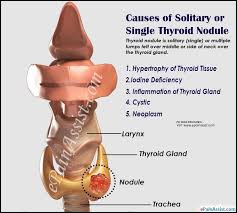 Pin On Endocrine Disorders