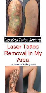 It's sandal season and every time you slip on your wedges you are reminded of the flower foot tattoo you got on spring break 2005! Tattoo Eraser Will Tattoo Removal Scar Low Cost Tattoo Removal Permanent Tatto Tattoos Tattooentfernung Haut Tattoo Tatowierungen