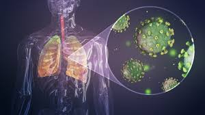Don't click on any links, please send it to phishing@sars.gov.za. Severe Acute Respiratory Syndrome Sars Patofisiologi Diagnosis Penatalaksanaan Alomedika