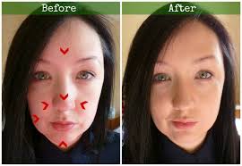 Here, learn how to use our best green concealer to combat redness. Before And After Green Concealer Colour Correction Redness Blemises Green Concealer Concealer Colors Color Correction