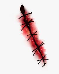 Apply your photo cutout on black background. Body Wounds Png Image Picsart Photoshop Png Full Hd Realistic Transparent Background Scar Png Png Download Transparent Png Image Pngitem