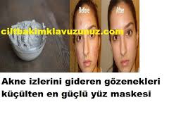 Tum Cilt Sorunlarini Gideren En Etkili Maske