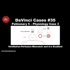 Image result for A-a Gradient