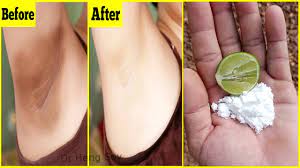Lemon is the ultimate natural bleaching agent. Whiten Dark Underarms Instantly Permanently 100 Effective At Home Youtube