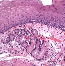 Check spelling or type a new query. Stratified Squamous Epithelium An Overview Sciencedirect Topics