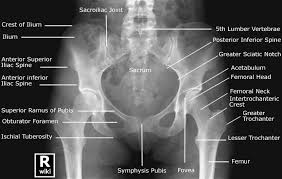 Pelvis Radiographic Anatomy Wikiradiography Radiology Student Medical Knowledge Radiography