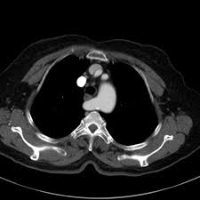 Pin On Chest Radiology