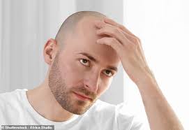 When the body falls into a state of stress such as lack of sleep, stress, depression, or a severe shock, this shock causes the hair follicles to stop developing state. Will A 1 000 Laser Cap Help Your Hair Grow Back Sound Health And Lasting Wealth