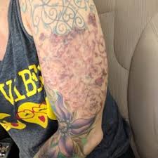 Laser hair removal is a procedure that utilises a concentrated beam of light. Laser Hair Removal In Kapolei Yelp