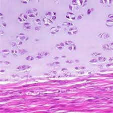 Epithelial tissue connective tissue >> areolar tissue >> adipose tissue this type of cartilage is made up of cells and matrix. Hyaline Cartilage