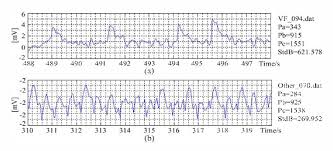 Importance of high quality chest compressions. Figure 2 From A Shockable Rhythm Detection Algorithm For Automatic External Defibrillators By Combining A Slope Variability Analyzer With A Band Pass Digital Filter Semantic Scholar