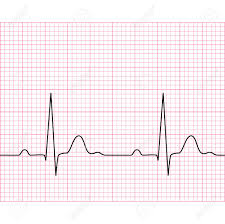 Illustration Of Medical Electrocardiogram Ecg On Chart Paper