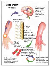 Pin On El Paso Neuropathy Institute