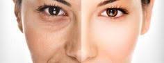 wie kann man under eye bags loswerden undereyesserum schonheit diy hautpflege hautpflege schonheit