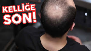 15 Dakikada Kellige Son Sac Dokulmesi Kurtulun Youtube