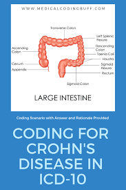 A Simple Belly Ache Or Crohn S Disease With An Abscess Medical Coding Buff