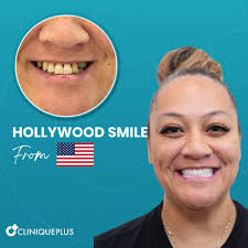 Transform Your Smile with Zirconium Crowns and Expert Care