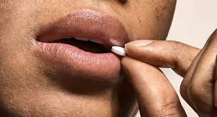 Valacyclovir (valtrex) for cold sores. Valacyclovir Valtrex For Cold Sores Hims