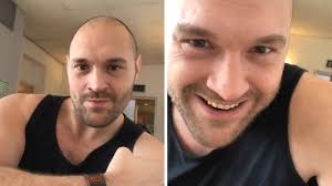 Whyte vs Browne live stream and TV channel: Watch heavyweight clash match 