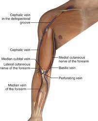 Venous Cutdown Clinical Gate