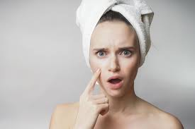 Si sigues este sencillo ritual diario, lograrás regular el exceso de sebo y tu piel se verá menos brillante y más los cosméticos también juegan un papel importante en el cuidado de las pieles con tendencia grasa. Acne O Piel Grasa Que Debo Hacer Neutrogena