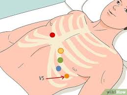We did not find results for: How To Put Ecg Leads On A Chest 15 Steps With Pictures