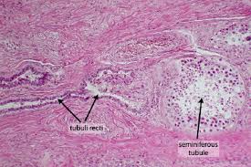 The tubule walls consist of a multilayered germinal. Description